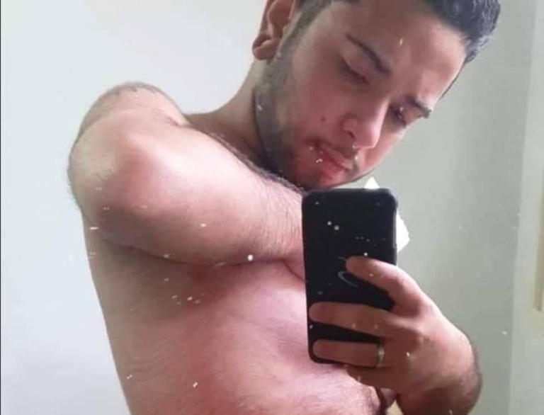 Jovem trans de Marília faz mastectomia após vaquinha e agradece apoio