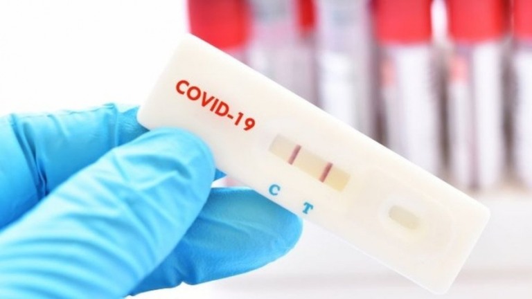 Covid-19: Brasil tem 120 mil novos casos e 854 mortes em 24h