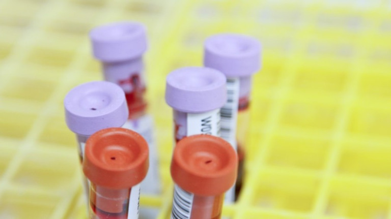 Câncer: casos aumentam no país, com destaque para pâncreas e fígado