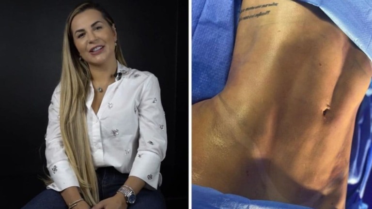 Reprodução/Divulgação Deolane Berreza faz Lipo Lad e impressiona com resultado Reprodução/Divulgação Deolane Berreza faz Lipo Lad e impressiona com resultado