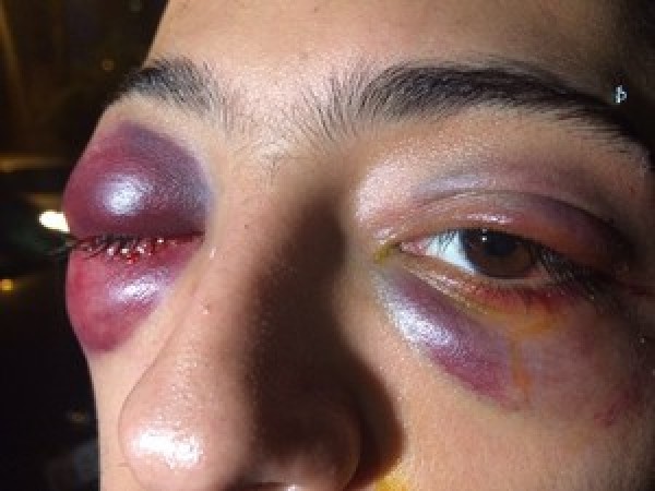 Estudantes divulgam relatos de agressão e fotos após ação da PM em república