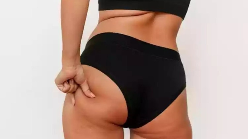 Divulgação Bananinha do bumbum: o que é e como tratar o incômodo na região?