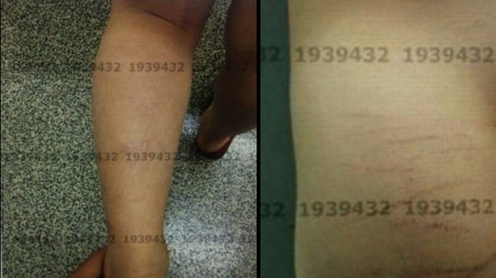 Pai é investigado por torturar filho de 5 anos, no Distrito Federal Pai é investigado por torturar filho de 5 anos, no Distrito Federal