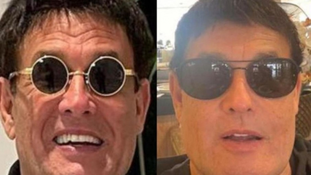Sérgio Mallandro realiza harmonização facial: 'Tô novinho' Sérgio Mallandro realiza harmonização facial: 'Tô novinho'
