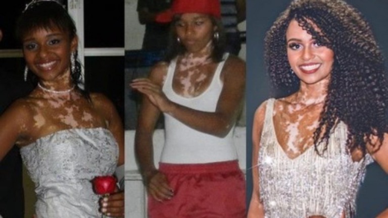 "BBB 22": Natália Deodato viveu trauma no casamento aos 15 anos