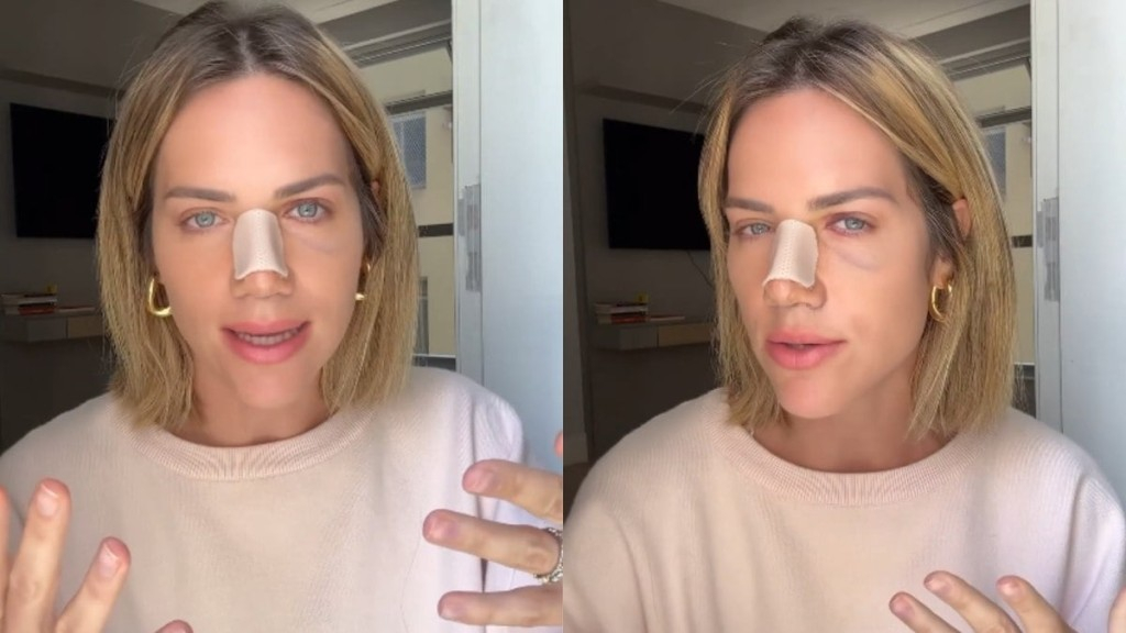 Reprodução Giovanna Ewbank revela motivo de cirurgia no nariz