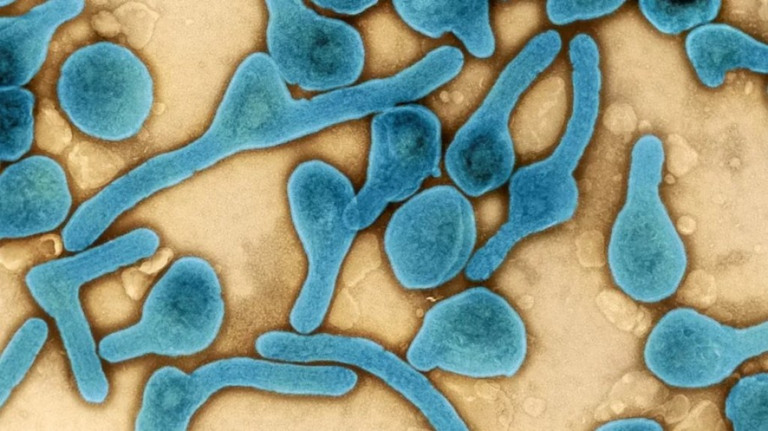 Em meio a novo surto, Uganda confirma mais seis casos de ebola