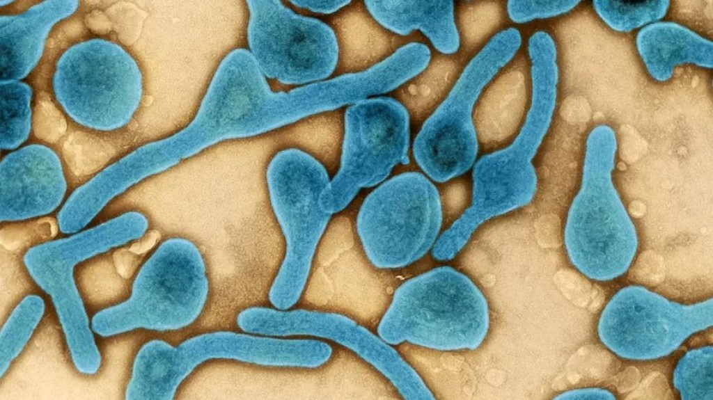 Em meio a novo surto, Uganda confirma mais seis casos de ebola