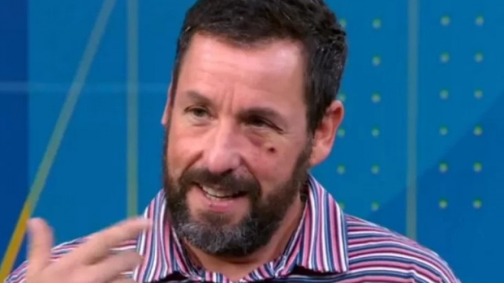 Adam Sandler aparece com olho roxo em programa de TV; saiba o motivo Adam Sandler aparece com olho roxo em programa de TV; saiba o motivo
