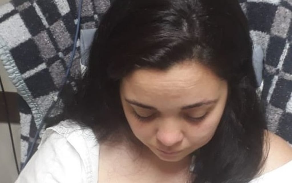 Após fazer escova progressiva no cabelo, mulher passa mal e é internada na UTI