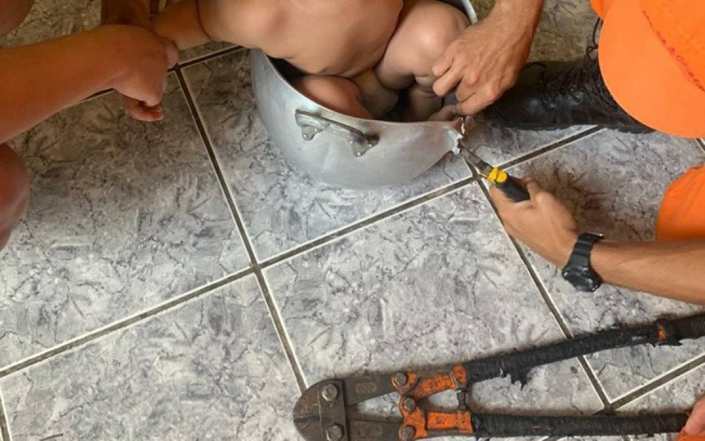 Garoto de 2 anos fica preso dentro de panela; veja fotos