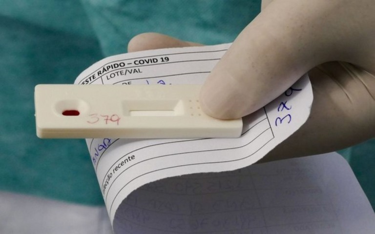 Nova etapa de testagem para novo coronavírus no Rio começa amanhã (31)