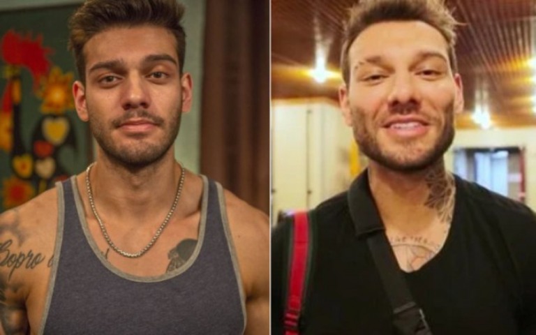 Lucas Lucco se arrependeu de harmonização facial e tenta reverter resultado