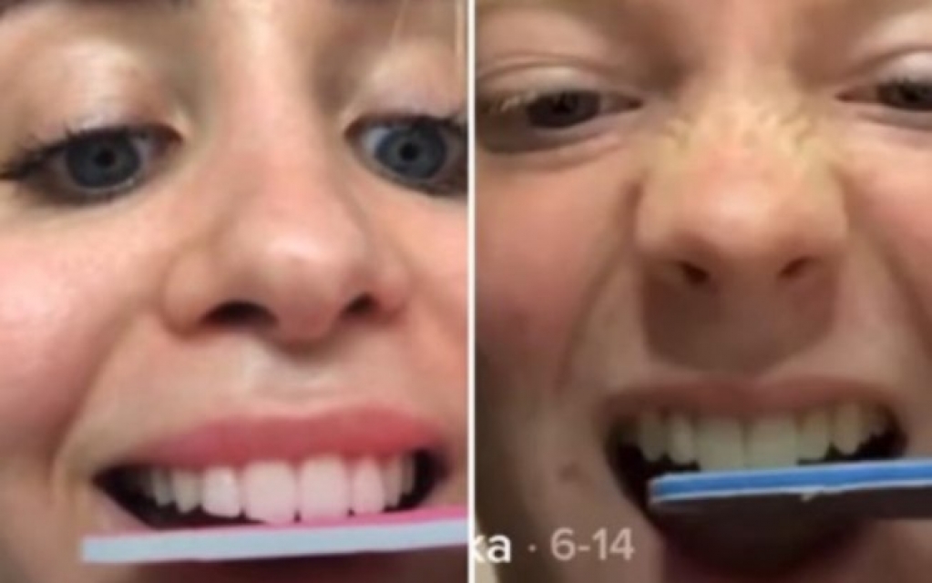 Novo desafio no TikTok com lixa de unha pode estragar os dentes, diz dentista