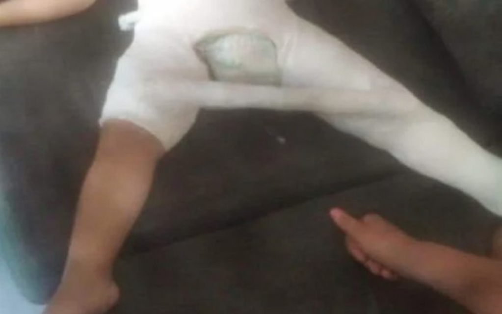 Mulher é presa por quebrar perna da filha de 3 anos Mulher é presa por quebrar perna da filha de 3 anos