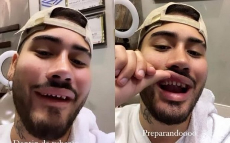 Kevinho surge sem lente nos dentes e choca fãs: "Fiquei horrorizado"