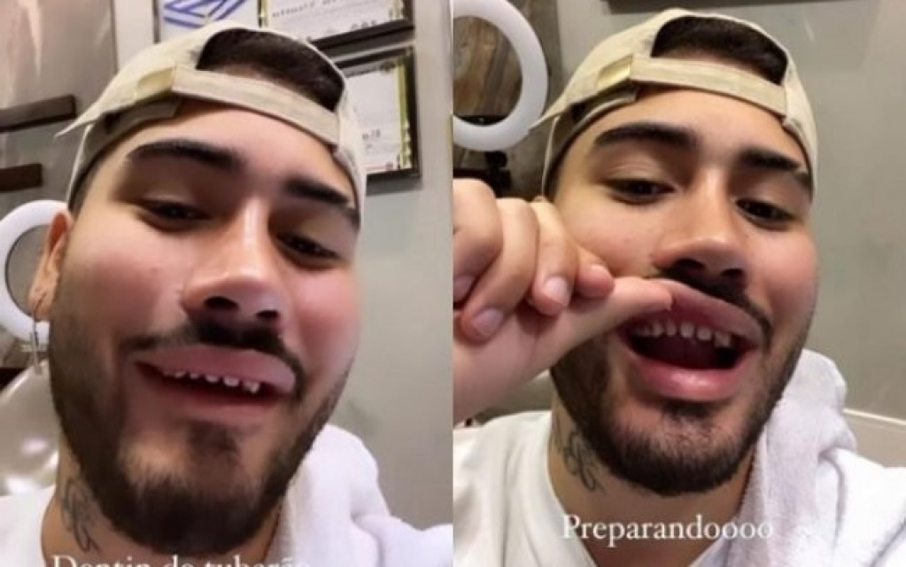 Kevinho surge sem lente nos dentes e choca fãs: "Fiquei horrorizado" Kevinho surge sem lente nos dentes e choca fãs: "Fiquei horrorizado"