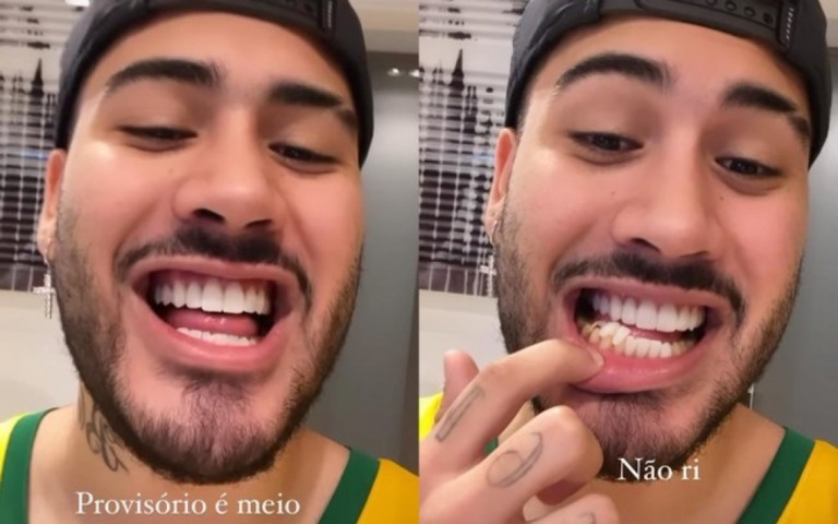 Kevinho mostra lentes dentárias quebradas: "Não ri"