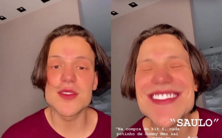 Web não está sabendo lindar com harmonização facial de Saulo Poncio; veja memes