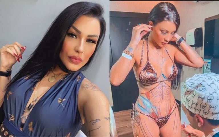 Filha de Gretchen faz mesma cirurgia plástica que Ludmilla