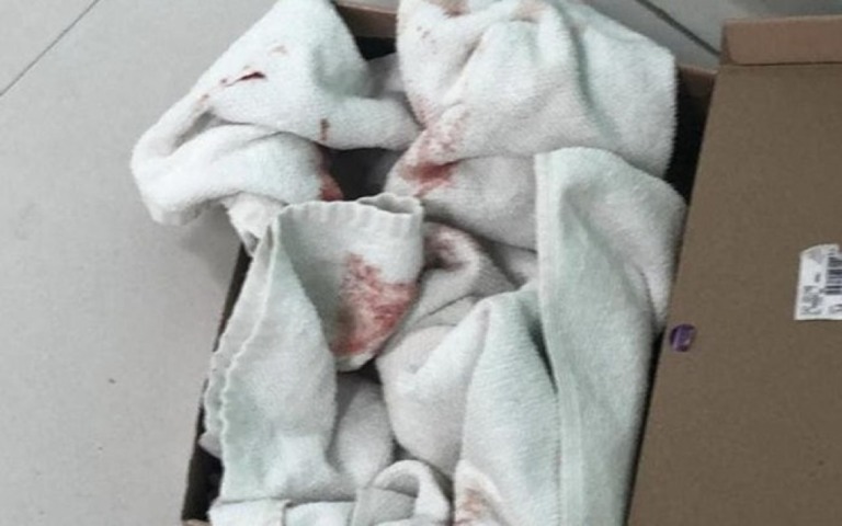 Catador encontra bebê recém nascido em lixeira de Balneário Camboriú