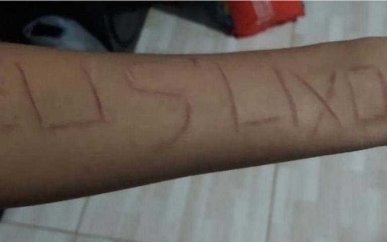 Denunciada, Flordelis perde guarda de filha adotiva que se automutilou; entenda