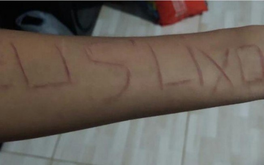 Denunciada, Flordelis perde guarda de filha adotiva que se automutilou; entenda Denunciada, Flordelis perde guarda de filha adotiva que se automutilou; entenda