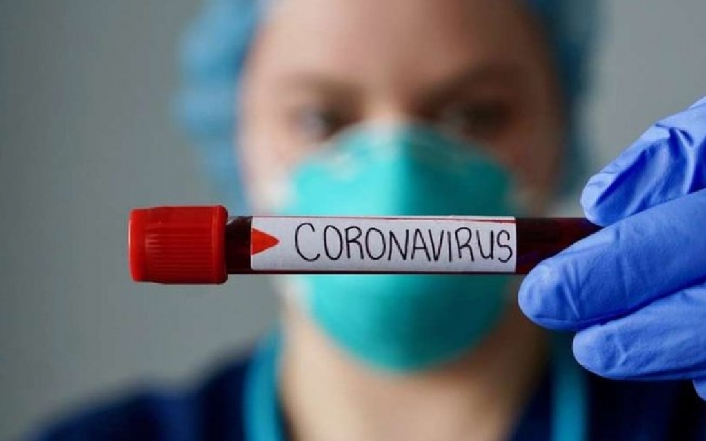 Anvisa aprova norma para estender validade de testes de Covid-19