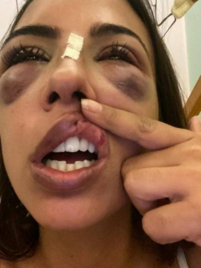Mulher é agredida por dois homens durante briga em Angra dos Reis (RJ)