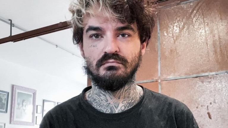 PC Siqueira usa andador devido doença degenerativa: "Quadril necrosado"