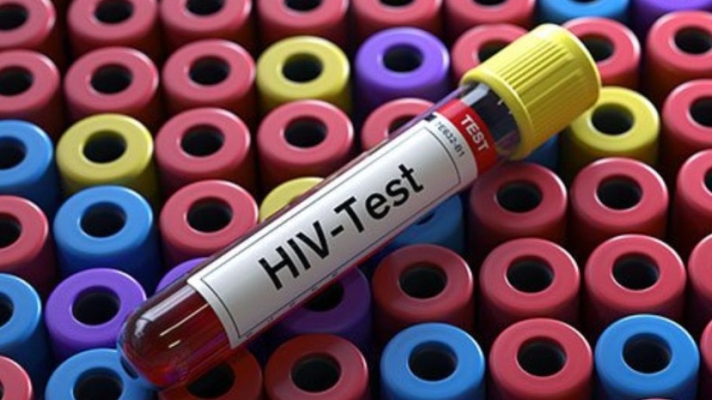 Universidades brasileiras testam eficácia de vacina contra o HIV