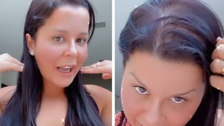 Maraisa diz que sofre de alopecia e mostra: "Sou carequinha aqui em cima"