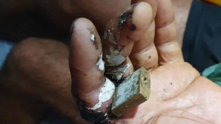 Bombeiros socorrem homem com cadeado preso no dedo há oito dias; veja