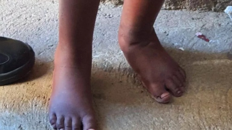Criança foi mantida em barril por pegar comida sem autorização, diz investigação
