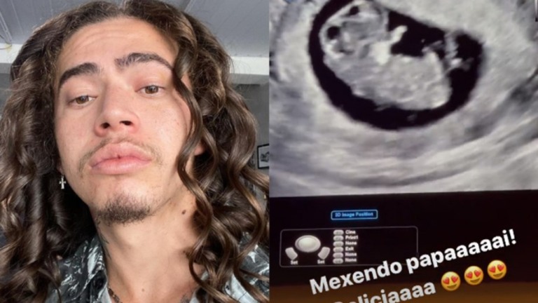 Whindersson Nunes conta que chorou ao ver ultrassom do filho: "Meu neném"