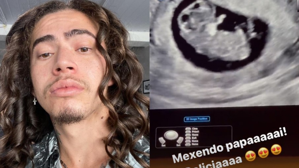 Whindersson Nunes conta que chorou ao ver ultrassom do filho: "Meu neném"