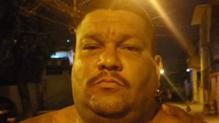 Rio: miliciano faz harmonização facial para despistar polícia, mas acaba preso