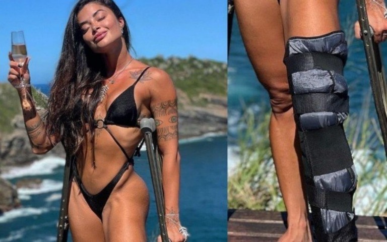 Aline Riscado sofre acidente: "Não estou conseguindo colocar o pé no chão"