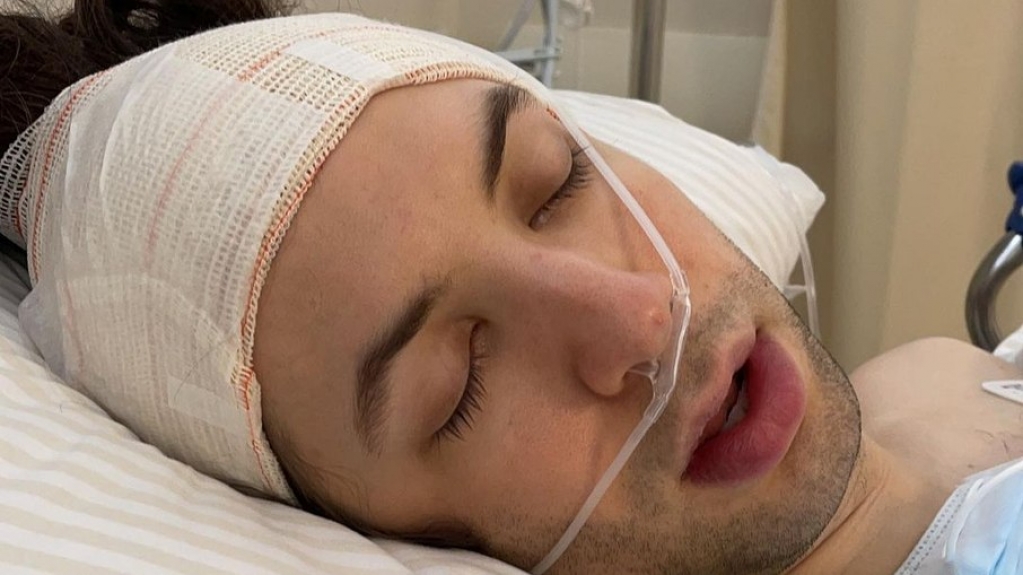 Lucas Jagger é hospitalizado por conta de tumor no ouvido Lucas Jagger é hospitalizado por conta de tumor no ouvido