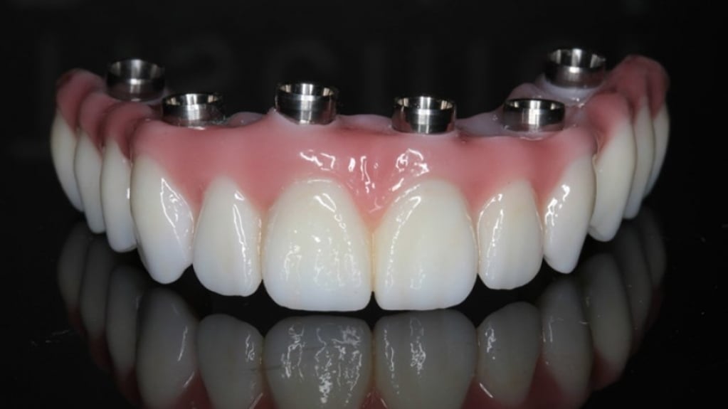 Protocolo dental tem que tirar para limpar?