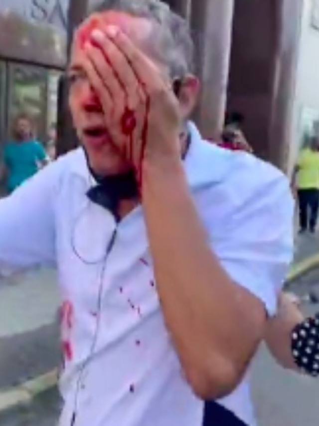Repressão encerra ato contra Bolsonaro no Recife; vereadora do PT é agredida
