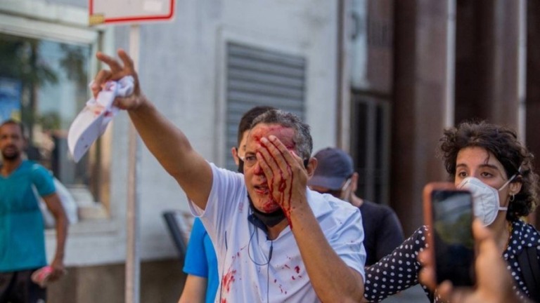 Comandante da PM é exonerado após violência em protestos contra Bolsonaro