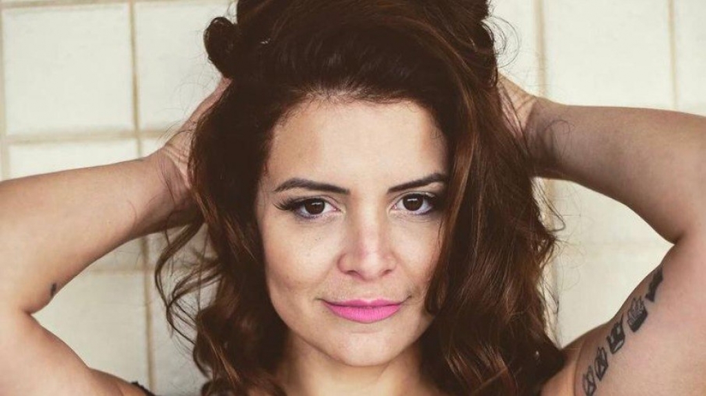 Ex-Chiquitita revela que perdeu movimento do olho após botox; veja Ex-Chiquitita revela que perdeu movimento do olho após botox; veja