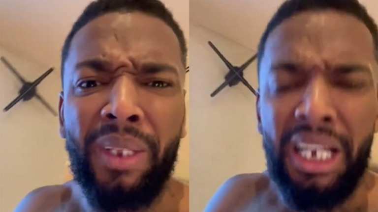 Nego do Borel perde um dente após bater a boca e brinca: "Perdi o Neymar" Nego do Borel perde um dente após bater a boca e brinca: "Perdi o Neymar"
