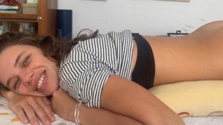 Bruna Linzmeyer trata dores e ansiedade com agulhas no bumbum