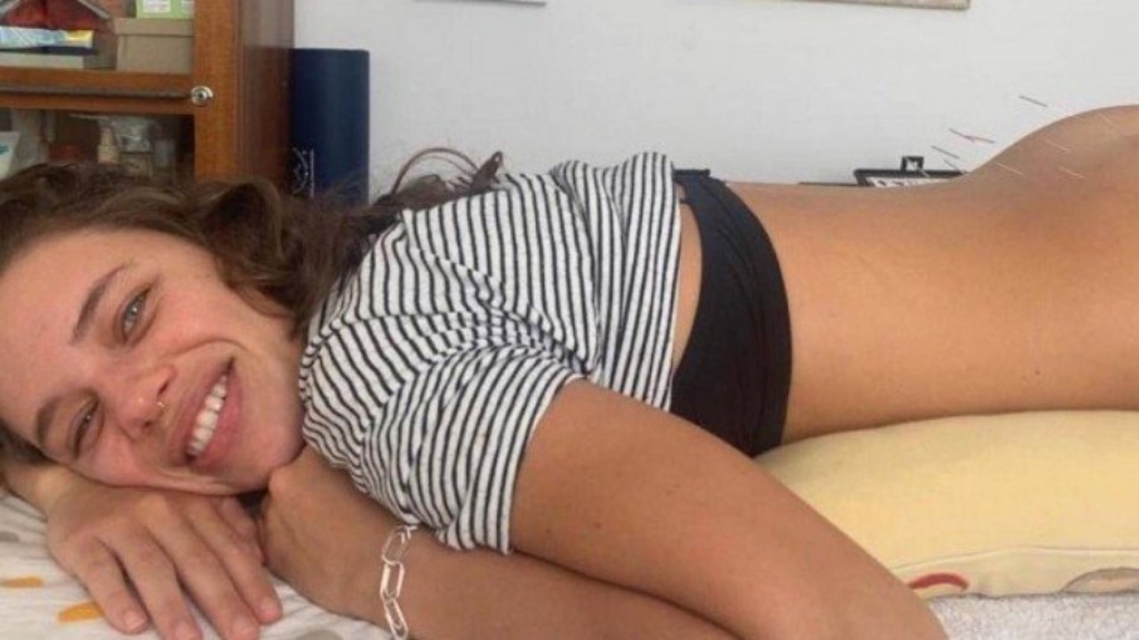 Bruna Linzmeyer trata dores e ansiedade com agulhas no bumbum Bruna Linzmeyer trata dores e ansiedade com agulhas no bumbum