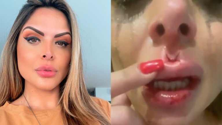 Irmão posta vídeo de apresentadora da Record machucada após ser agredida pelo ex