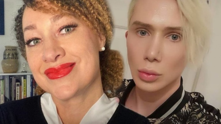 Rachel Dolezal apoia influencer que tenta mudar de raça