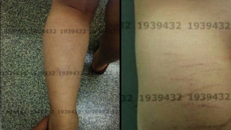 Pai é investigado por torturar filho de 5 anos, no Distrito Federal