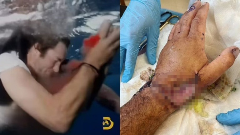 Ator de 'Jackass' é mordido por tubarão durante filmagens; veja o vídeo